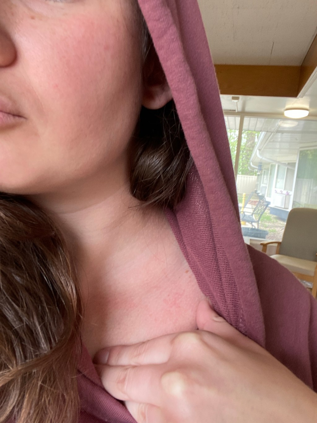 Lack of a left&nbsp;clavicle